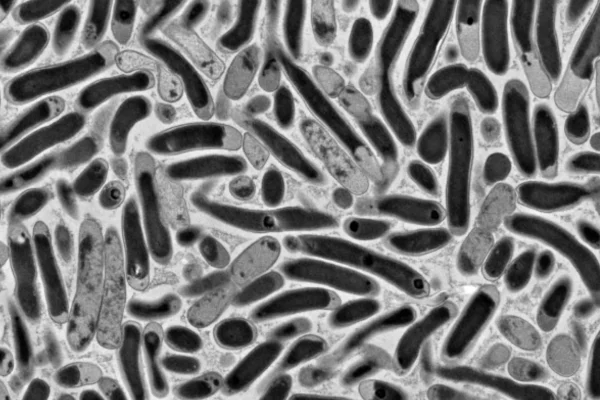 Israeli scientists move closer to producing food from CO₂ in breakthrough research