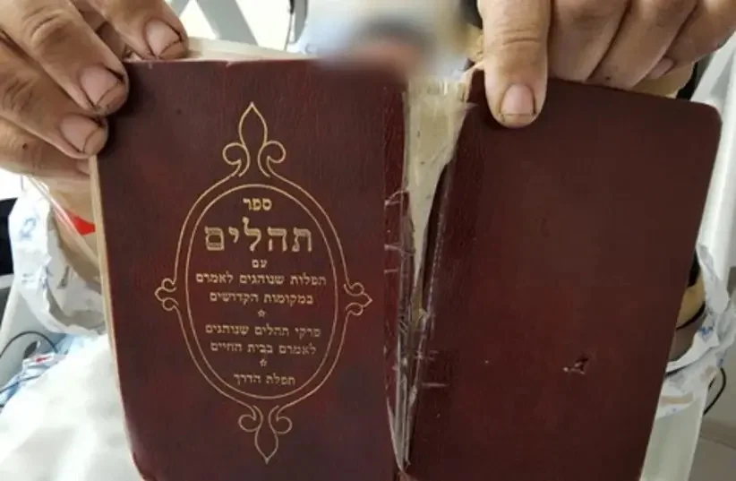 The Book of Psalms held by the bombing victim, which prevented a shard of debris from piercing his body. (Photo: Shaare Zedek Medical Center)