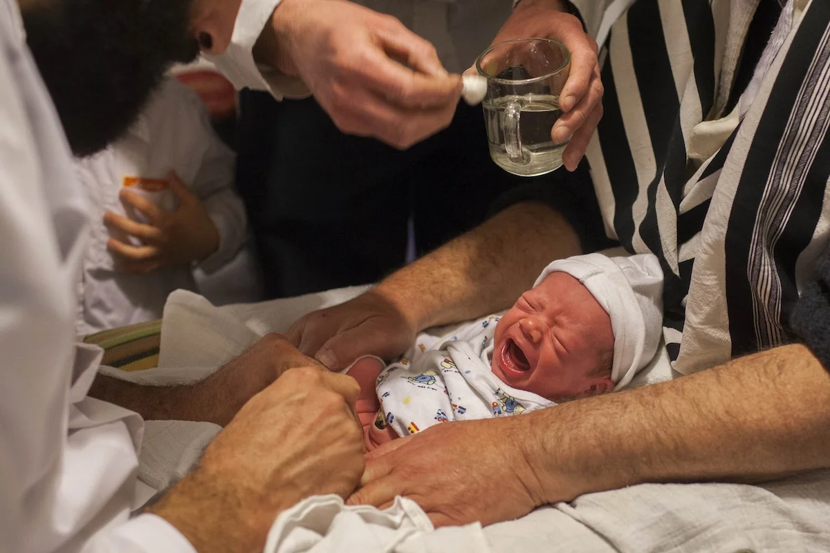 Ritual circumcision
